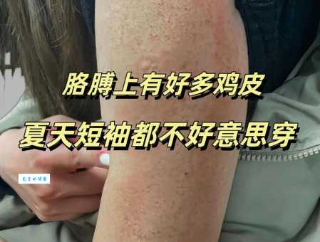 脸部皮肤粗糙的原因是啥？这篇文章帮你找答案！