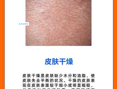 秋季保养皮肤小常识，学会这几招告别干燥起皮！