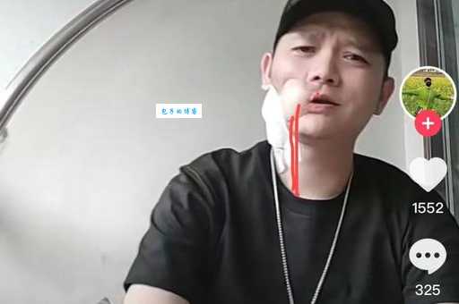 傅松个人资料大全：了解歌手傅松的音乐历程与抗癌经历