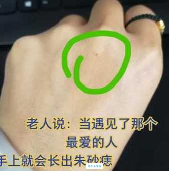 朱砂痣是什么样子 中医角度解析它的形成原因