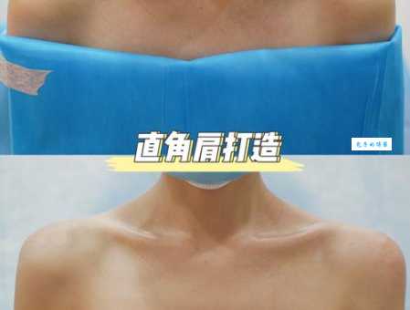 蝴蝶骨是什么它与直角肩有什么区别