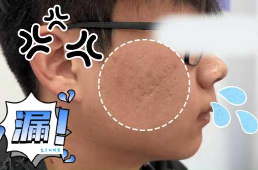 坑坑洼洼是什么意思 专家详细解读