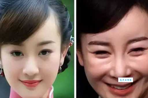 张檬整容前后对比照片 她为什么选择整容