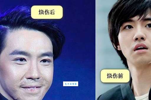 俞灏明最新电视剧盘点 演技获观众一致好评