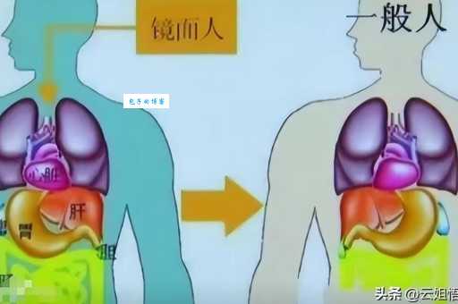 镜面宝宝是什么意思 家长如何正确照顾这类婴儿
