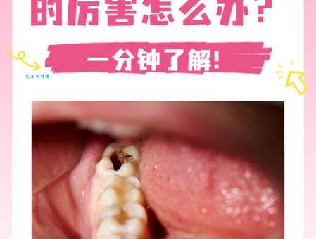 龋齿打一字你能猜到是哪个字吗
