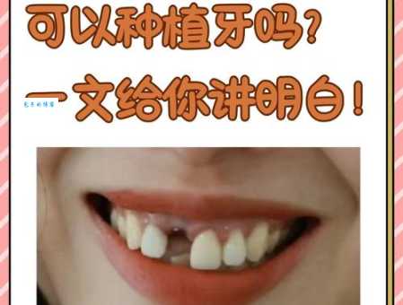 北门南牙啥意思?专家来给你讲讲其中门道!