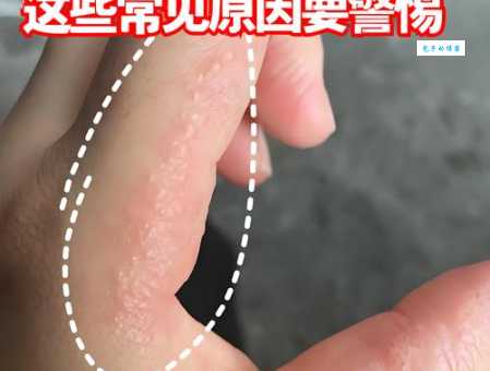 揭秘自然界什么不怕开水烫？原来我们平时都见过它！