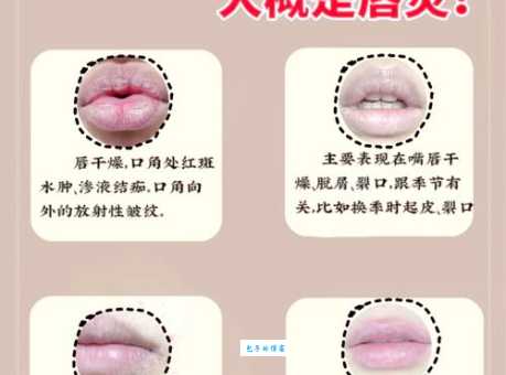 强唇劣嘴是什么意思?它的具体解释和出处都在这里了