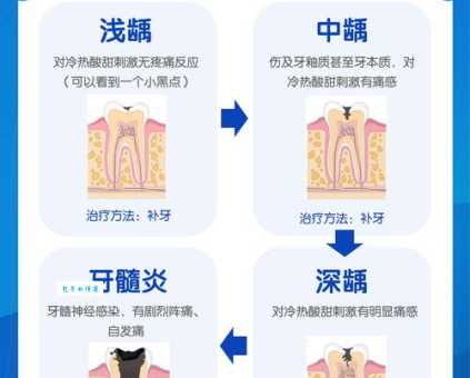 哪类人更容易患龋齿?做好这几点让你远离牙痛烦恼!