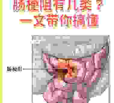 老一辈常说的鸡肠狗肚到底什么意思？赶紧来了解一下！